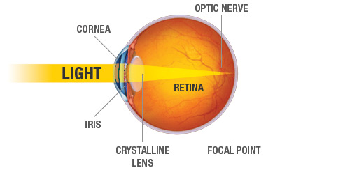 LASIK_Diagram